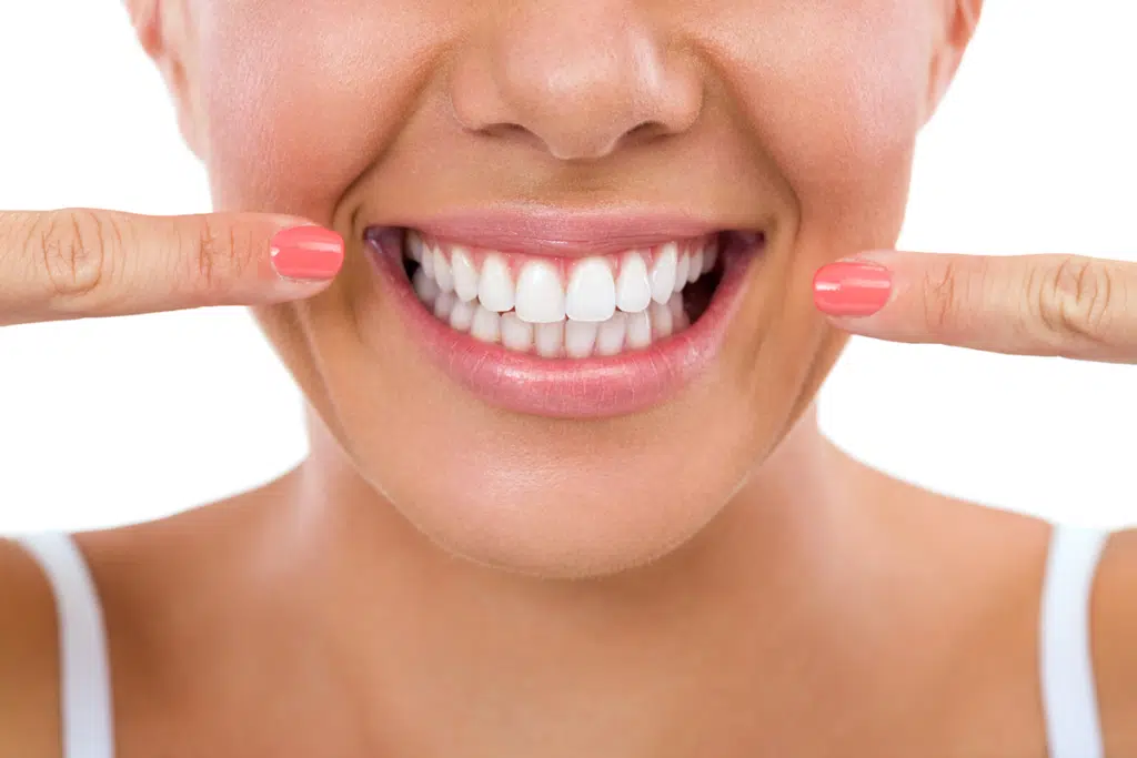 What is the Cost of Teeth Whitening in Golden Valley, MN?